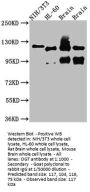 OGT Recombinant Monoclonal Antibody