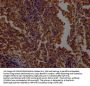OGT Recombinant Monoclonal Antibody