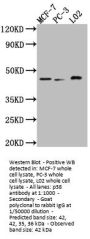 MAPK14 Recombinant Monoclonal Antibody
