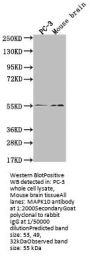 MAPK10 Recombinant Monoclonal Antibody