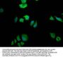 FASN Recombinant Monoclonal Antibody