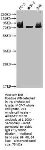 MEN1 Recombinant Monoclonal Antibody