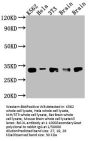 BCL2L1 Recombinant Monoclonal Antibody