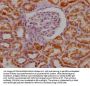 MAOA Recombinant Monoclonal Antibody