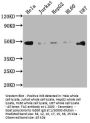 FAS Recombinant Monoclonal Antibody