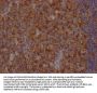 FAS Recombinant Monoclonal Antibody