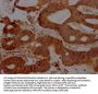 FAS Recombinant Monoclonal Antibody