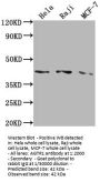AGTR1 Recombinant Monoclonal Antibody