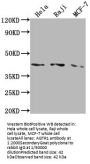 AGTR1 Recombinant Monoclonal Antibody
