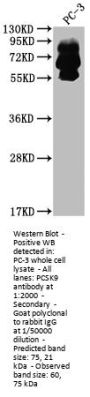 PCSK9 Recombinant Monoclonal Antibody
