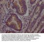 PCSK9 Recombinant Monoclonal Antibody