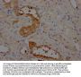 AGT Recombinant Monoclonal Antibody