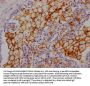 ACE Recombinant Monoclonal Antibody