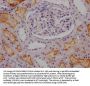 ACE Recombinant Monoclonal Antibody