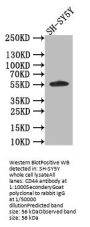 AKT1/2/3 Recombinant Monoclonal Antibody