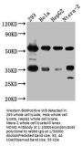NONO Recombinant Monoclonal Antibody
