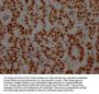 NONO Recombinant Monoclonal Antibody