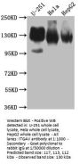 ITGAV Recombinant Monoclonal Antibody