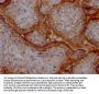 ITGAV Recombinant Monoclonal Antibody