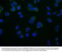 RAB25 Recombinant Monoclonal Antibody
