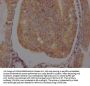 ADRB2 Recombinant Monoclonal Antibody
