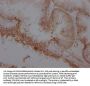 ADRB2 Recombinant Monoclonal Antibody