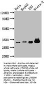 CASP3 Recombinant Monoclonal Antibody