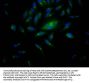 RPS6KB1 Recombinant Monoclonal Antibody