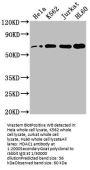 HDAC1 Recombinant Monoclonal Antibody