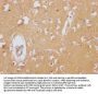 CLU Recombinant Monoclonal Antibody
