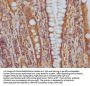 ITGAV Recombinant Monoclonal Antibody