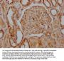 ITGAV Recombinant Monoclonal Antibody