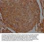 FLNA Recombinant Monoclonal Antibody