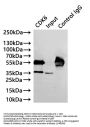 CDK6 Recombinant Monoclonal Antibody