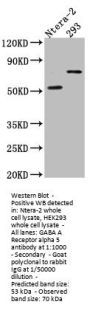 GABRA5 Recombinant Monoclonal Antibody