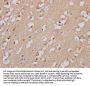 GABRA5 Recombinant Monoclonal Antibody