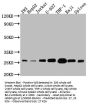 BCL2 Recombinant Monoclonal Antibody