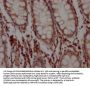 BCL2 Recombinant Monoclonal Antibody