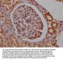 SMN1 Recombinant Monoclonal Antibody
