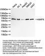 PRKAA1 Recombinant Monoclonal Antibody