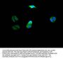 PIK3CA Recombinant Monoclonal Antibody