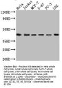 MAPK14 Recombinant Monoclonal Antibody