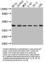 MAPK14 Recombinant Monoclonal Antibody