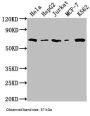 HDAC2 Recombinant Monoclonal Antibody