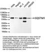 SQSTM1 Recombinant Monoclonal Antibody
