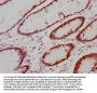 CA9 Recombinant Monoclonal Antibody