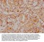 CA9 Recombinant Monoclonal Antibody