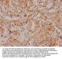 CA9 Recombinant Monoclonal Antibody