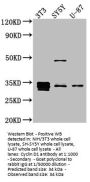 CCND1 Recombinant Monoclonal Antibody