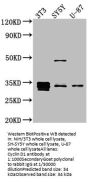 CCND1 Recombinant Monoclonal Antibody
